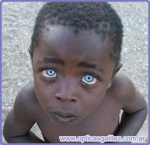 Niño africano de ojos azules